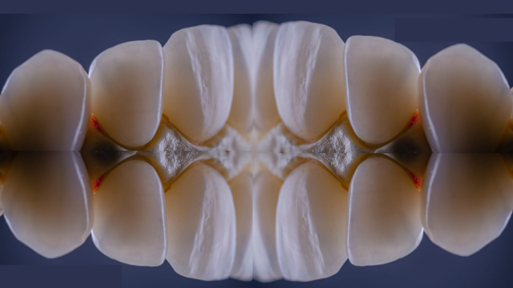Laboratório de prótese dentária Rio das Ostras - Laboratório digital - help dental lab - Sidney Júnior tpd - Laboratório Macaé - Protético - Lente de contato dental - Laboratório de prótese Cabo Frio